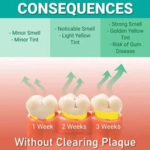 Ultrasonic Tooth Cleaner - Image 13
