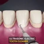 Ultrasonic Tooth Cleaner - Image 12